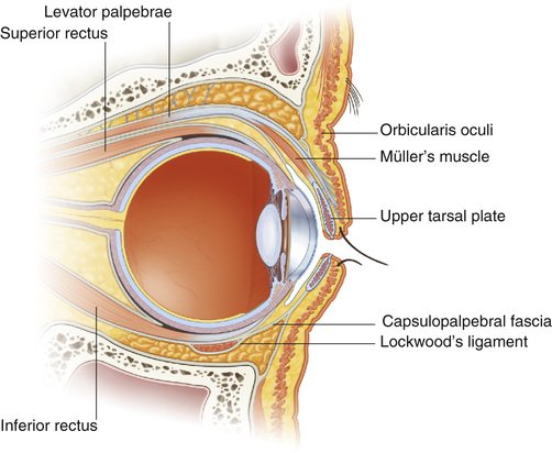 Anatomical cross-section of the eyelid showing the levator, Müller's muscle, tarsal plate and surrounding structures
